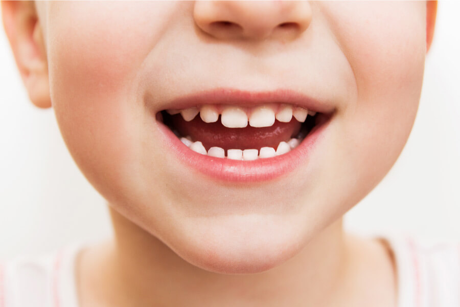 Closeup of a child with their baby teeth that are important to care for