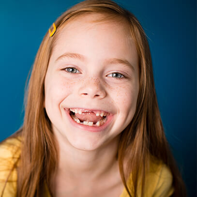 girl smiling with missing teeth