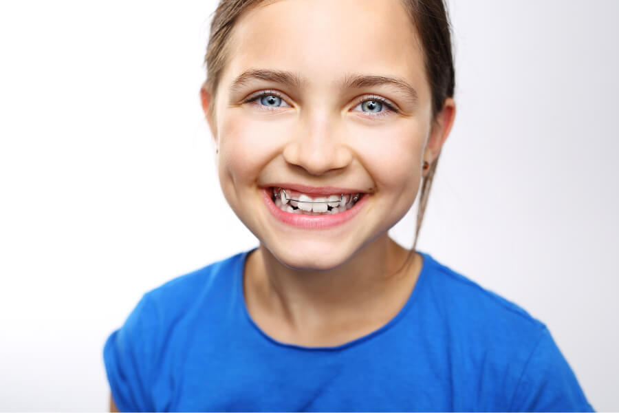 Brunette 7 year old smiles after receiving interceptive orthodontic treatment in Tyler, TX, at Storybook Smiles